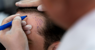 HairGen™ Booster for Hair Loss