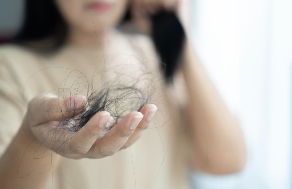 Postpartum Hair Loss
