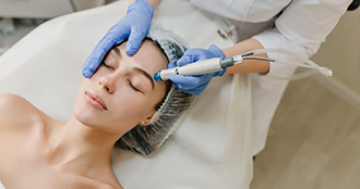 Microdermabrasion